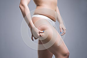 Woman holding fold of skin, cellulite on female body, gray background photo