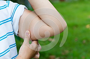 Woman holding a hand with excess fat. photo