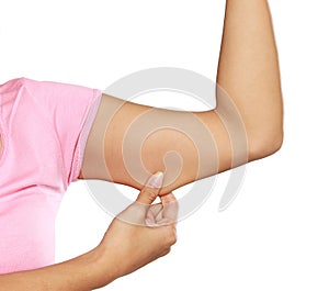 Woman holding a hand with excess fat photo