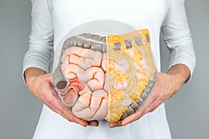 Woman holding model of human intestines in front of body