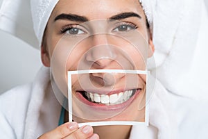 Woman Holding Photo Of Toothy Smile photo