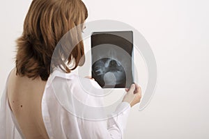 Woman holding an X-ray of her sinusis