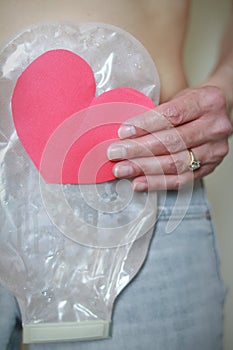 Woman holding a red heart while wearing a two piece colostomy bag