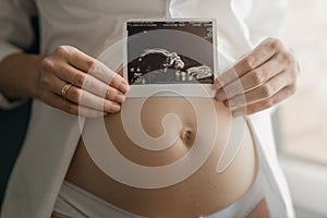 Woman holding an ultrasound scan of her unborn baby