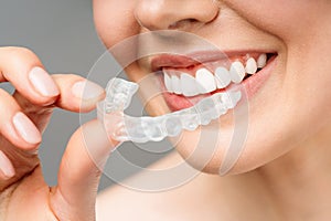 The woman holds in her hand removable invisible transparent aligners, and smiles.