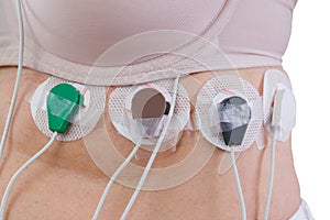 Woman with holter monitor device for daily monitoring of electrocardiogram and blood pressure