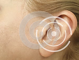 Woman hurts ear medicine sickness concept