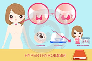 Woman with hyperthyroidism