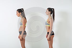 Woman with impaired posture position defect scoliosis and ideal bearing photo