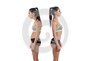 Woman with impaired posture position defect scoliosis and ideal bearing