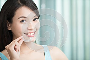 Woman with invisible braces