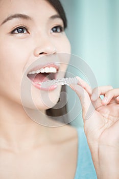 Woman with invisible braces