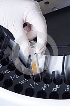 Woman loading samples in analyzer