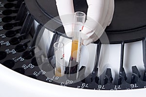 Woman loading samples in analyzer