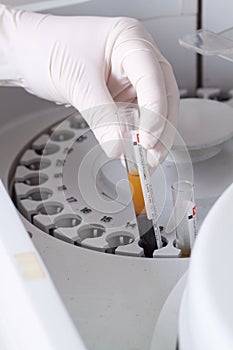 Woman loading samples in biochemical analyzer