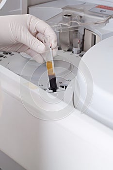 Woman loading samples in biochemical analyzer