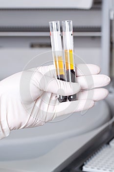 Woman loading samples in biochemical analyzer