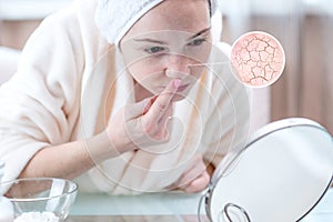 Woman looking at her dry skin with cracks and with first wrinkles. Circles increase the skin like a magnifying magnifier