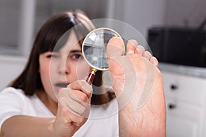 Woman Looking At Her Toe Nails With Magnifying Glass