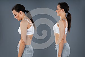 Woman With Lordosis And Normal Curvature