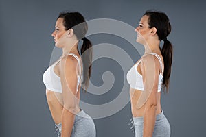 Woman With Lordosis And Normal Curvature photo