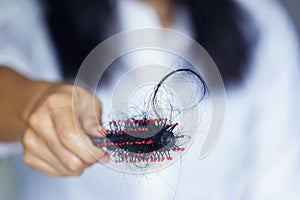 Woman losing hair on hairbrush in hand