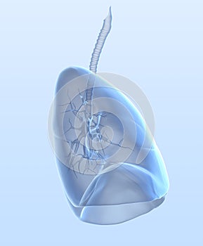 Woman with lung cancer, medically 3D illustration on light blue background