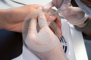 Woman manicurist removing cuticle and pterygium using apparatus, closeup view. photo