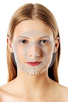 Woman marked out for cosmetic surgery. Isolated on white.