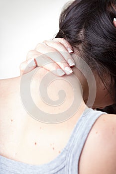 Woman massages neck to soothe cervical pain