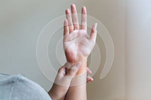 Woman massaging her painful hand. Healthcare and medical concept