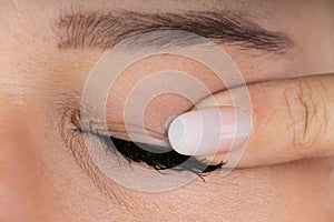 Woman Massaging Infected Eye photo