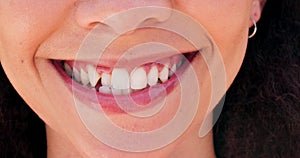 Woman, mouth and teeth whitening with veneers for dental closeup, smile and happiness on face for health. Orthodontics