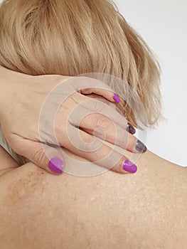 Woman with neck and shoulder pain
