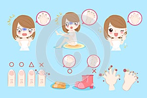 Woman with onychomycosis