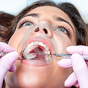 Woman with open mouth at dental check up