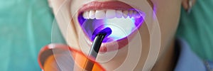 Woman with open mouth on dentist appointment try whitening procedure