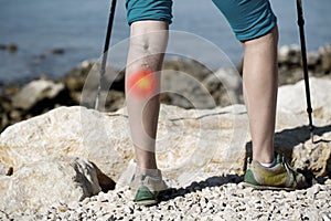 Woman with painful varicose veins on a leg with red dot effect