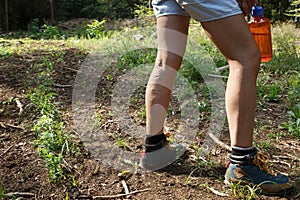 Woman with painful varicose veins on legs resting on a walk through nature photo