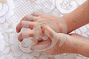 A woman with Parkinson`s disease has her hands shaking