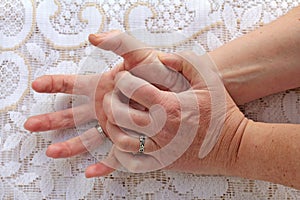 A woman with Parkinson`s disease has her hands shaking