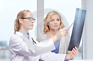 Woman patient and doctor with spine x-ray scan