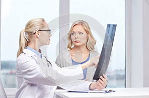 Woman patient and doctor with spine x-ray scan