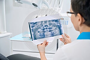 Woman periodontist examining x-ray image of patient jaw photo