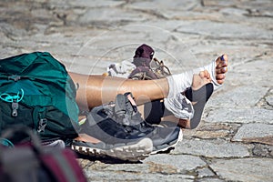 Woman pilgrim legs with injured feet resting on Obradoiro square, Santiago de Compostela, Spain photo