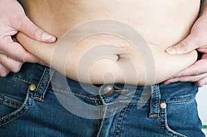 Woman pinching fat from her abdomen