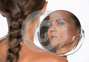 Woman with plastic surgery marks on face looking in mirror