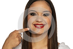 Woman pointing on her dentures