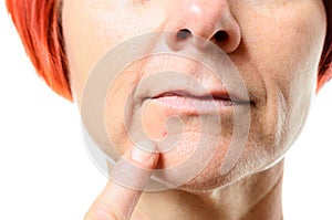 Woman pointing to blemish on chin photo