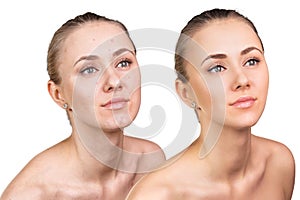 Woman with problem skin on her face